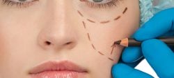 face lifting